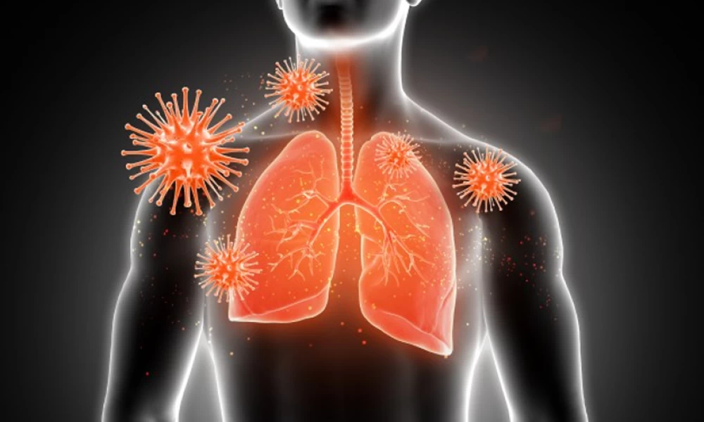 Κορονοϊός: Μην περιμένετε ότι θα εξαφανιστεί το καλοκαίρι λέει καθηγητής Παθολογίας Λοιμώξεων